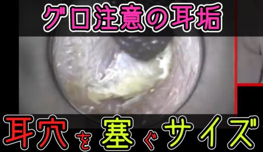 【エガちゃんねる】無修正グロ注意！耳掃除で大きすぎる耳垢発見！取れてスッキリする耳かき動画【江頭切り抜き】